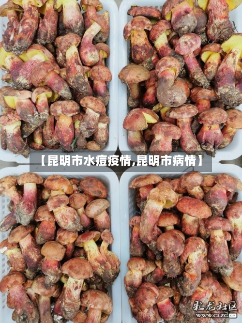 【昆明市水痘疫情,昆明市病情】-第2张图片