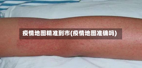 疫情地图精准到市(疫情地图准确吗)