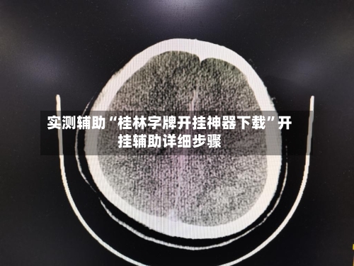 实测辅助“桂林字牌开挂神器下载”开挂辅助详细步骤-第2张图片